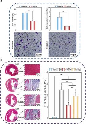 Stimuli-responsive hydrogels: smart state of-the-art platforms for cardiac tissue engineering